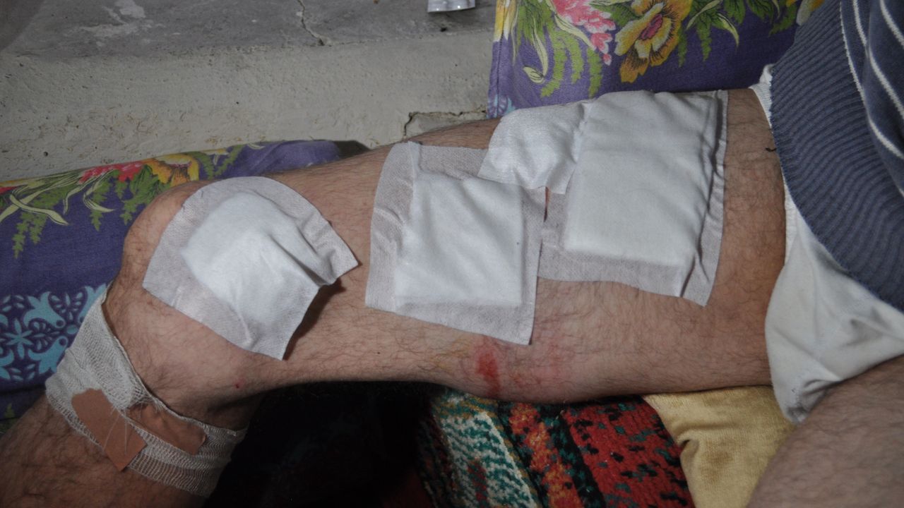 Eskişehir'de ayı saldırısı: Şans eseri yaralı kurtuldu