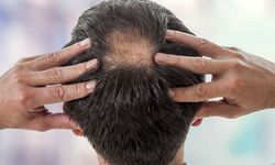Saç Dökülmesi Neden Olur, Nasıl Tedavi Edilir?
