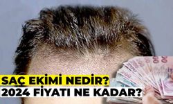 Saç Ekimi Nedir ve Nasıl Yapılır? 2024 Saç Ekim Fiyat Aralıkları