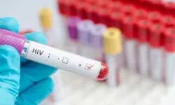 HİV Testi ile Sağlığınızı Kontrol Edin ve Bilinçlenin