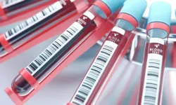 NİPT Testi Prenatal Dönemde Bebeğin Genetik Risklerini Erken Tanıma Yöntemi