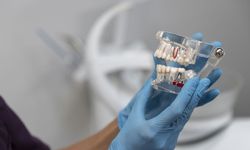 Konyaaltı’nda Diş Sağlığında İki Başlık Öne Çıkıyor: Kanal Tedavisi ve Diş Kaplama Uygulamalarına Talep Artıyor