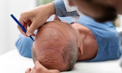 Konya DHI Saç Ekimi Fiyatları 2026