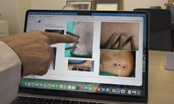 Türk Bilim İnsanlarından Dünyada Bir İlk: Enfeksiyonu Bitiren Yapay Kemik!