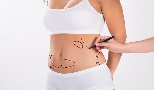 Liposuction Sonuçları Beklentiler ve Gerçekler