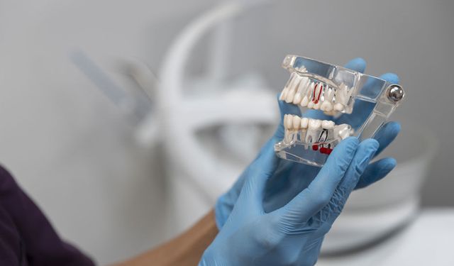 Konyaaltı’nda Diş Sağlığında İki Başlık Öne Çıkıyor: Kanal Tedavisi ve Diş Kaplama Uygulamalarına Talep Artıyor