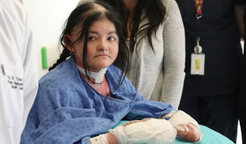 Amerikalı Ledesa’nın parmakları Eskişehir’de yapılan ameliyatla açıldı